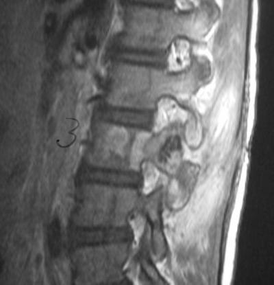 Slide 16